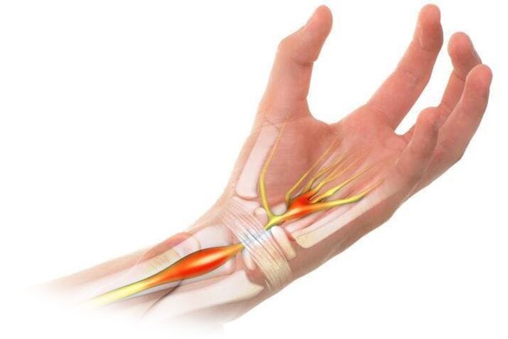 Pain with joint inflammation