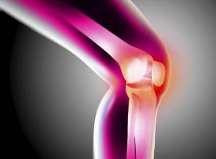 Distorting osteoarthritis